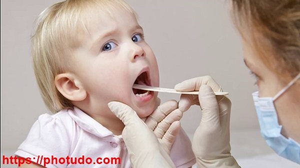 bệnh polyp dây thanh quản